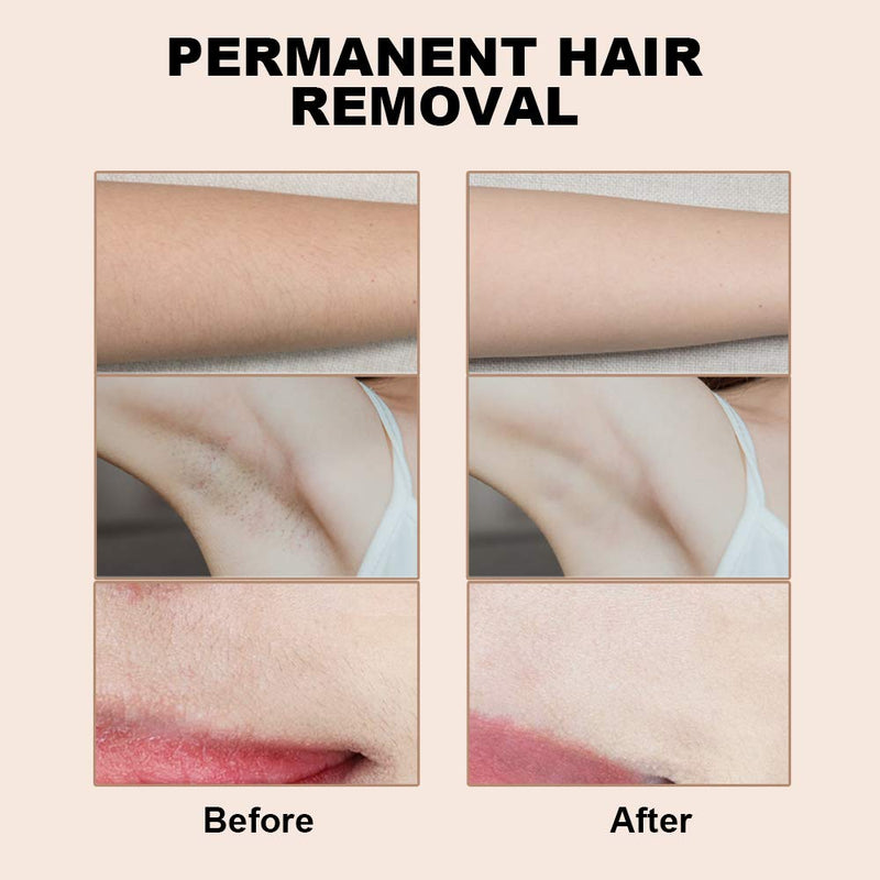 IPL Hair Removal Device, Laser Hair Removal, Facial Hair Removal for Women with 999900 Flashes